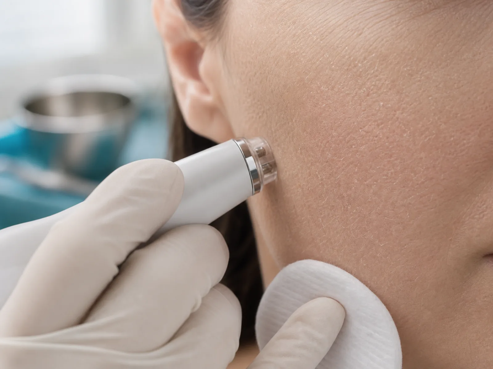 Evaluarea hidratarii pielii terne cu sonda dermatologica pe zona obrazului