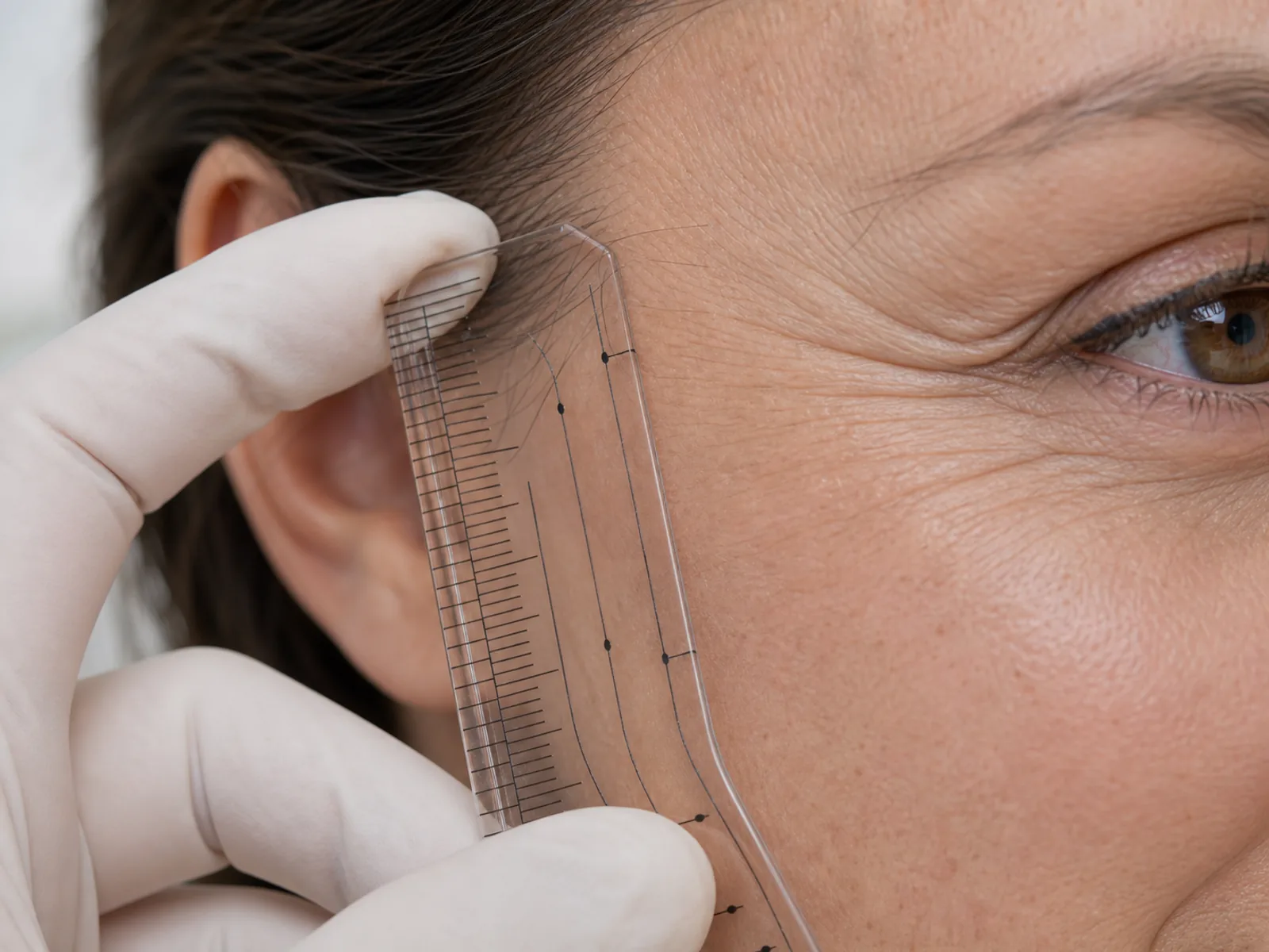 Facial wrinkles and expression lines - senior doctor consultation Assessment of expression lines around the eye with a transparent facial ruler
